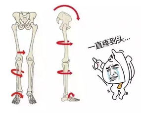 知识分享 X型腿 脊柱侧弯 骨盆前倾的罪魁祸首就是它 上