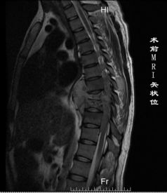 骨与关节创伤的治疗