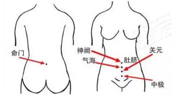 痛经 宫寒 不用怕 神威中医堂三伏贴来帮您