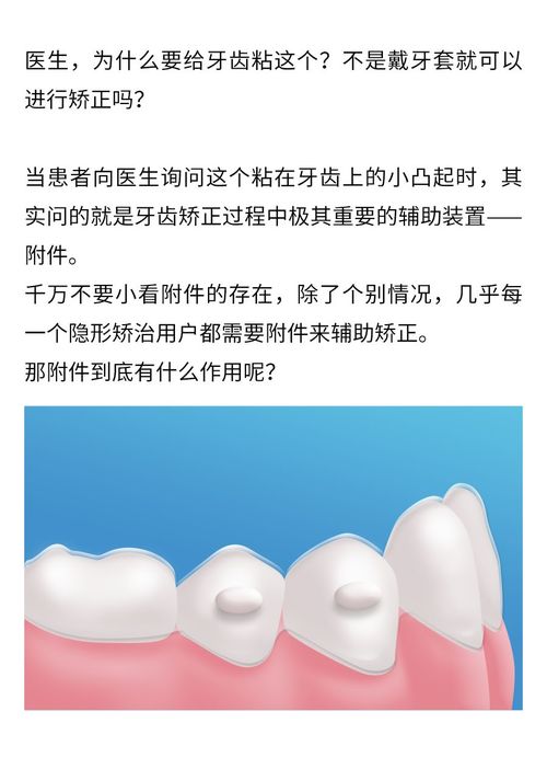 医生,为什么戴牙套,还要粘这个