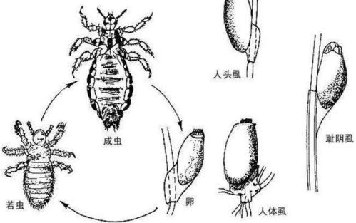 这是真的 与人类共存,活上千万年了,为何虱子现今很难见到了