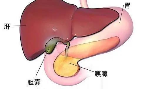 胆囊炎需要把胆摘除吗