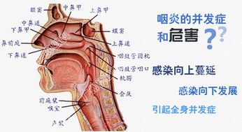 咽炎吃什么好