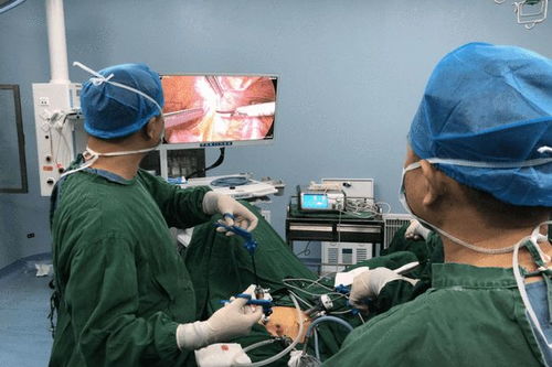 阜南县中医院为82岁老人成功开展腹腔镜下直肠癌根治术