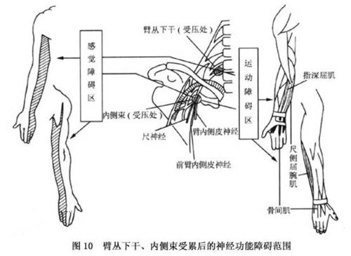 前臂外侧和手指触电样疼痛的诊断 如何鉴别前臂外侧和手指触电样疼痛 查症状 