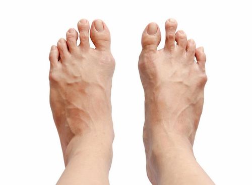 体内有病,脚知道 脚上若有这6种表现,当心疾病找上自己