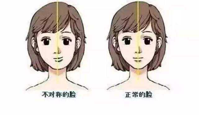 大小脸可以通过正颌永久改善吗 不做的话,脸会越来越歪吗