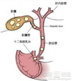 胆结石开刀后有肠胃问题怎么办