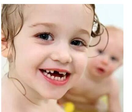 4岁儿童蛀牙，需要补牙嘛(4岁孩子蛀牙需要补吗)