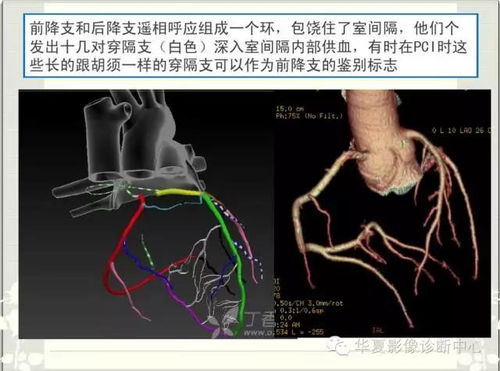  冠脉lcx是什么意思,什么是冠脉LCX ? 钱包应用