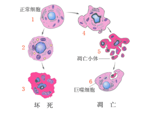 细胞凋亡的3种途径是什么 