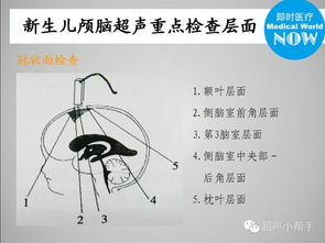 探究TMT热成像检测颅脑的可行性