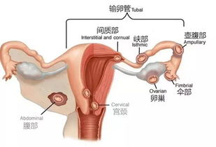 这钱你不能省,宫外孕也会出人命的