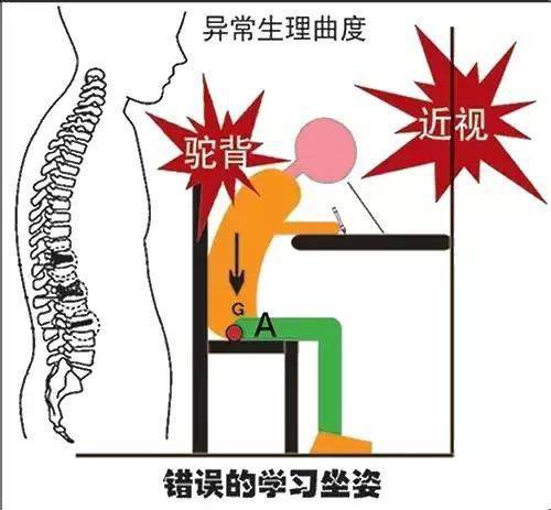 这22种矫正方法对青少年驼背有效