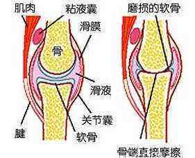 为什么练瑜伽之后会感觉膝盖疼痛 