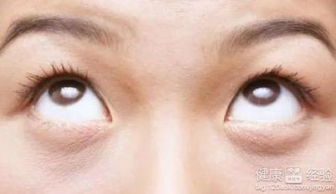 经常转动眼球可以恢复视力(今日分享～视力康复训练方式)