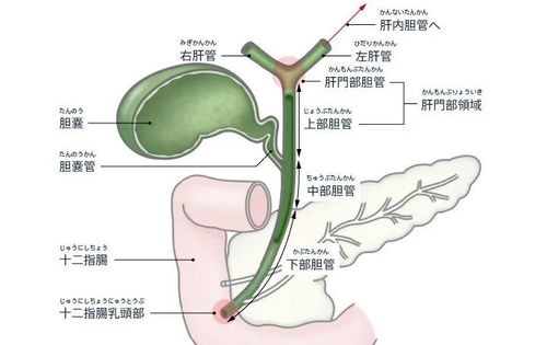 胆管扩张怎么办