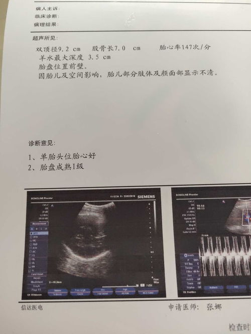 孕39周 6了,羊水少了还能不能补上去哪