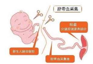 脐带血有必要保存吗 