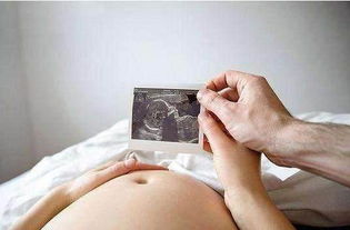 怀孕八个月胎儿却腹中死亡,医生抢救之后,怒骂家人是禽兽 