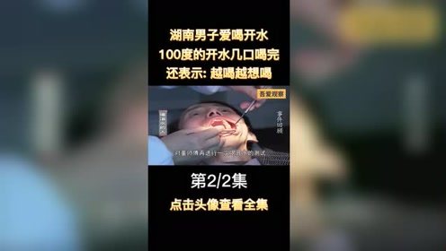 湖南男子爱喝开水,100度的开水几口喝完,还表示 越喝越想喝 2