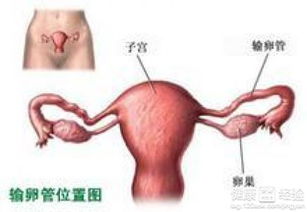 女性如何预防输卵管阻塞