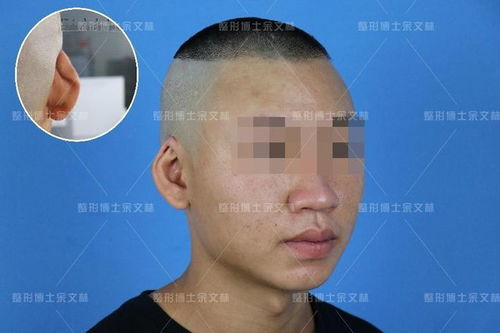 龙钞隐耳版和不隐耳 龙钞隐耳版和不隐耳 专题