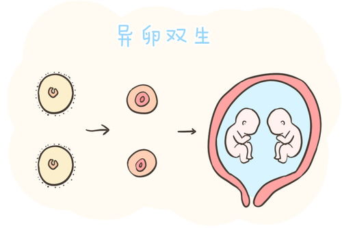 异卵双生和同卵双生的区别