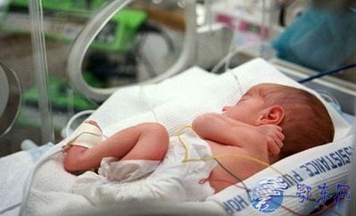 英国奇迹宝宝迎来一岁生日出生时体重仅300克