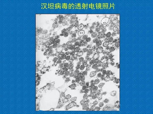 汉坦病毒的主要传染源,汉坦病毒非常罕见，为何说大部分汉坦病毒是由啮齿类动物传染给人类的？