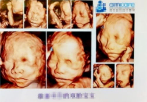 胎儿四维彩超照片(四维照片跟真婴儿对比一点也不像是怎么回事)