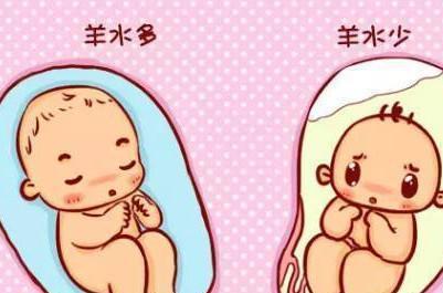 刘强东妹妹羊水栓塞去世, 孕期羊水异常易引发3大症状, 如何预防