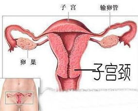 不完全纵隔子宫的情况，以后还有没有生双胞胎的可能(不完全纵隔子宫可以怀双胞胎吗)