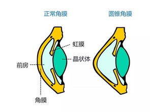 散光知识你知多少