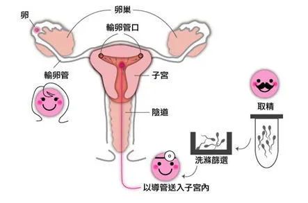 点击收藏 ▏测试一下,快来算算你的怀孕机会还有多少次