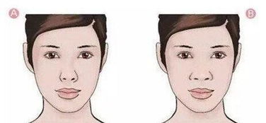 女人塌鼻子面相不好,做鼻综合整形能改变什么 