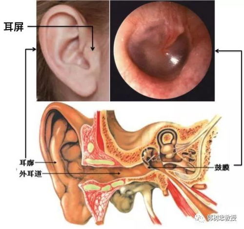 你的孩子十有八九没有外耳道 