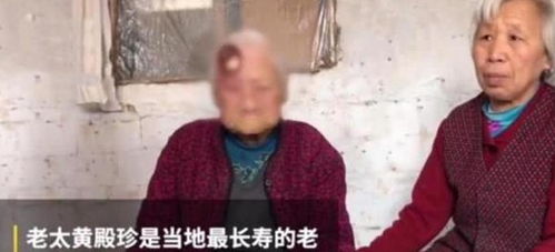 106岁老太磕破头,露出白骨,儿子 那么大年纪没必要送医院