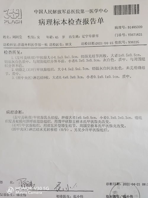 做了甲状腺全切手术三个月需要不需要做碘131 