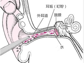 充耳不闻为哪般