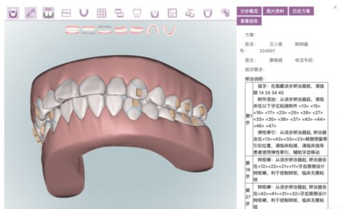 严谨 规范 高效 美立刻正畸医学设计团队实在是太给力了