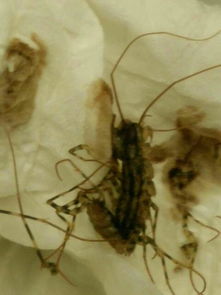 大家来看看这是什么虫子 朋友在云南被这种虫子蛰了一下,特别疼,一个小白点,要不要看医生啊 