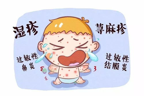 春季过敏高发期,宝宝们该如何预防