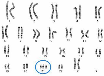 育孕百科 胚胎染色体会自己变异常吗