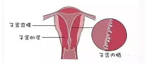内膜太薄需要怎么调理