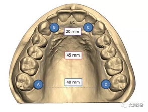 ada dental prophylaxis,Understanding ADA Dental Prophylaxis: A Comprehensive Guide for You