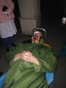 70多岁老人凌晨独自楼梯摔伤 洛阳民警赶到帮其送医救治