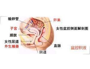 盆腔积液是什么原因(盆腔积液是什么原因造成的危害大吗)