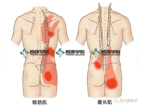 上背部疼痛的十三块肌肉总结