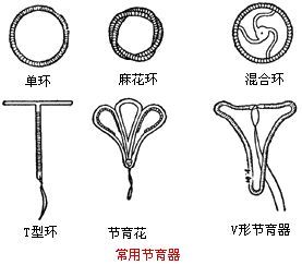 女性避孕环的种类图片图片